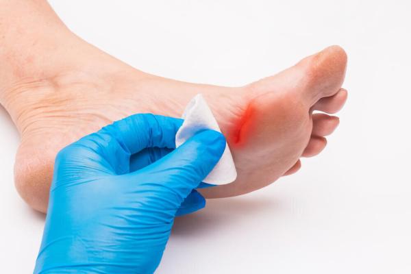 Advanced Diabetic Wound Care NYC - Oleg Karpenko Podiatry PC
