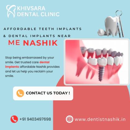 Affordable Teeth Implants & Dental Implants Near Me | Nashik