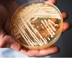 Candida auris, Latest Worry for the U.S. Healthcare