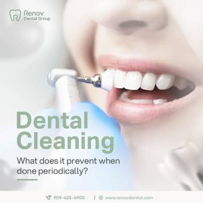 Dental Implants in Claremont