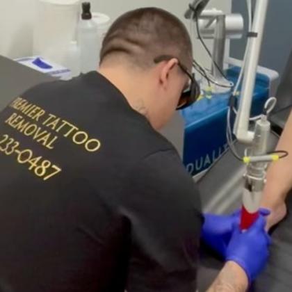 Effective Toenail Fungus Treatment in McKinney