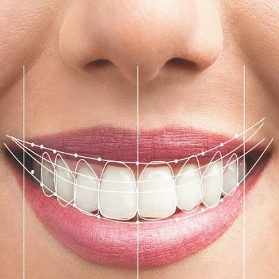 Elite Smiles Dental Center