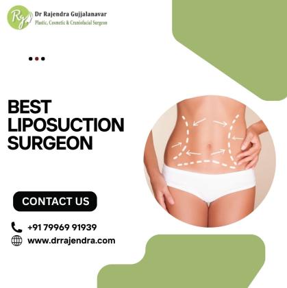 Liposuction Surgery in Bangalore | Safe & Effective Fat Removal