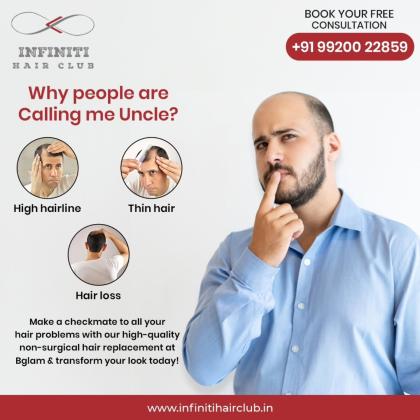 Non-Surgical Hair Replacement in Mumbai, Andheri | Infiniti