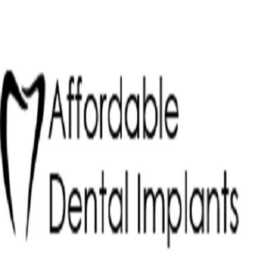 Queens Affordable Dental Implants
