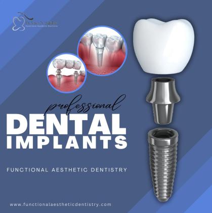 Restore Your Smile with Dental Implants in Summerlin!