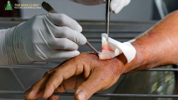 Wound Care Specialist