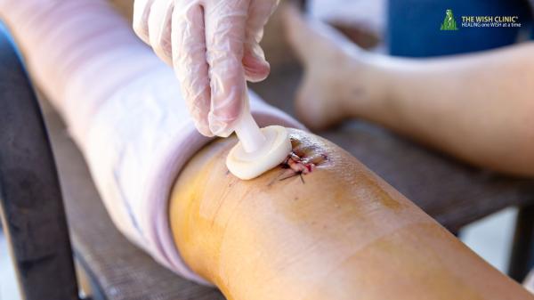 Wound Care Specialist