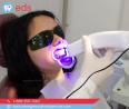Affordable Dental Implant in Cornelia, GA 30531 | Emergency Dental Service