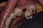 Biological Dentist in Tijuana, Mexico – Safe, Natural Dental Care