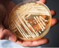 Candida auris, Latest Worry for the U.S. Healthcare