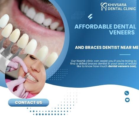 Affordable Dental Veneers and Braces Dentist Near you