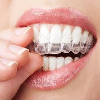 Dental Implants Maromoneck