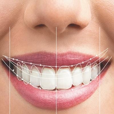 Elite Smiles Dental Center