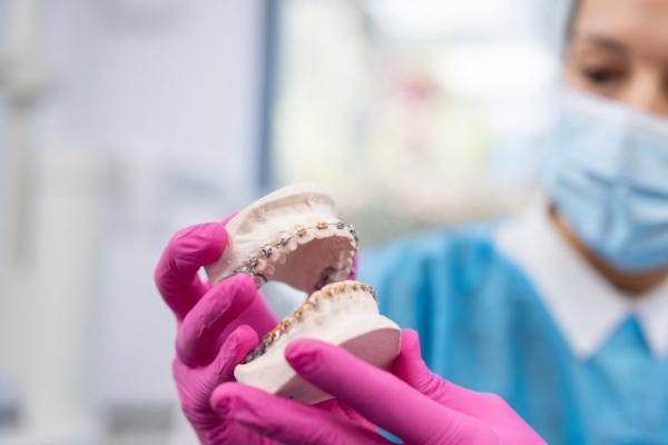 Ferntree Gully Orthodontics – Creating Perfect Smiles