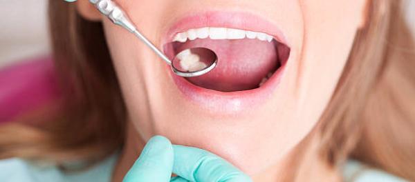 Trusted Nelson Dental Centre for All Your Family’s Needs!