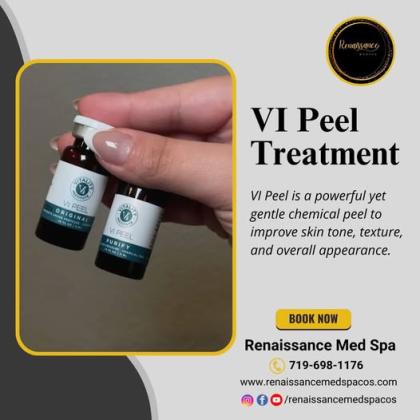 VI Peel Treatment Near Me