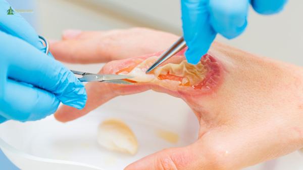 Wound Care Clinic