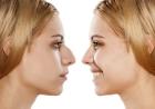 rhinoplasty surgery in punjab