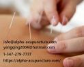 Best cupping therapy treatment in New York