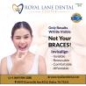 Clear Aligners in Dallas